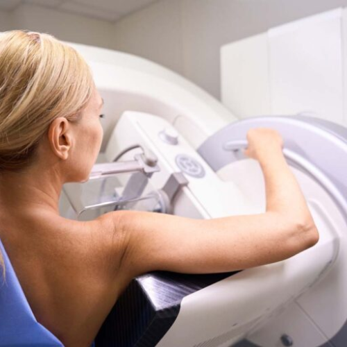 Mammogram2025 768x512jpg